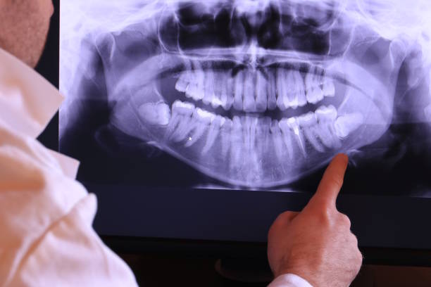 Best Emergency Broken Tooth Repair in Baxter, TN