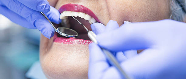 Best Emergency Broken Tooth Repair in Baxter, TN